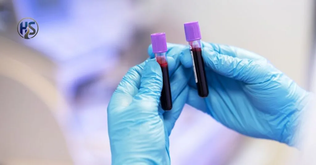 Blood Analysis MCHC