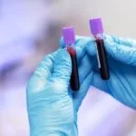 Blood Analysis MCHC